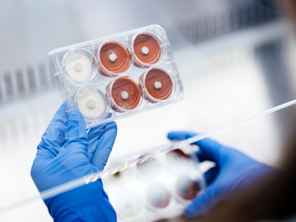 ‘Super fungi’ a greener pathway for critical minerals recovery